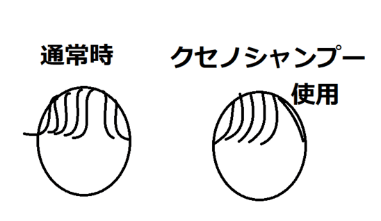 クセノシャンプー使用時の前髪